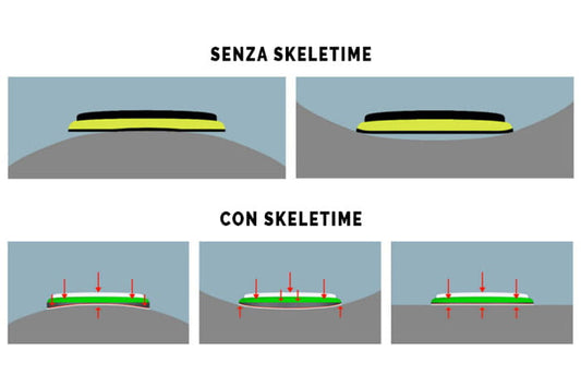 Skeletime® la differenza tecnica